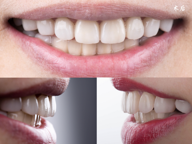 Kina dental lab tillverkningsteknik av zirconia lång bro