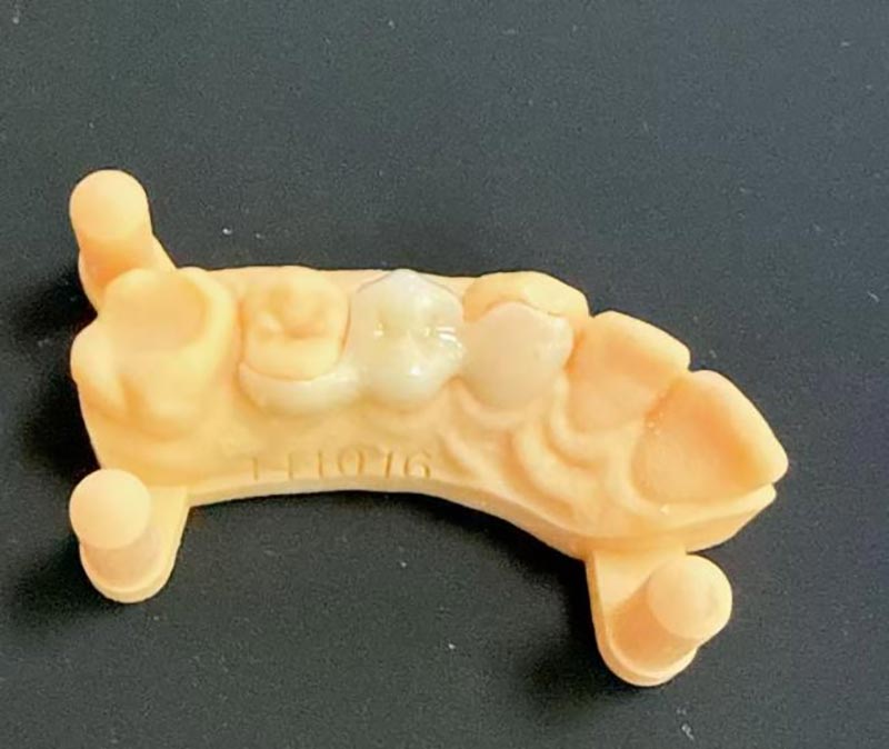 Vad du behöver veta om Maryland Bridges?