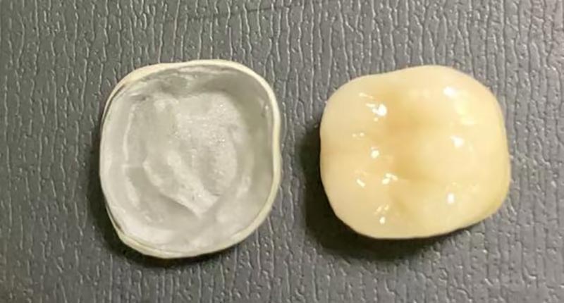 WM DENTAL LAB – Ett ledande kinesiskt tandlaboratorium