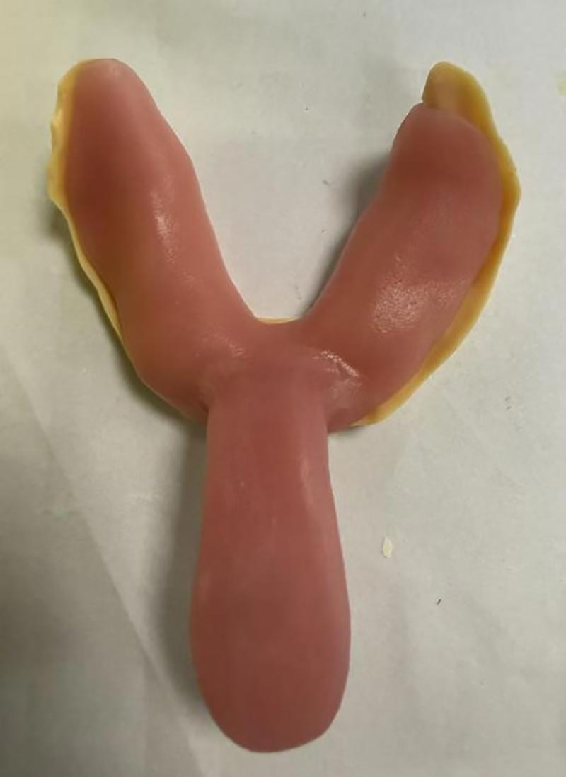 Saker du inte visste om anpassade tandbrickor