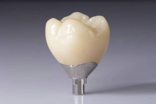 Optimera dina resultat med Zirconia-restaureringar (kronor, broar, implantat)