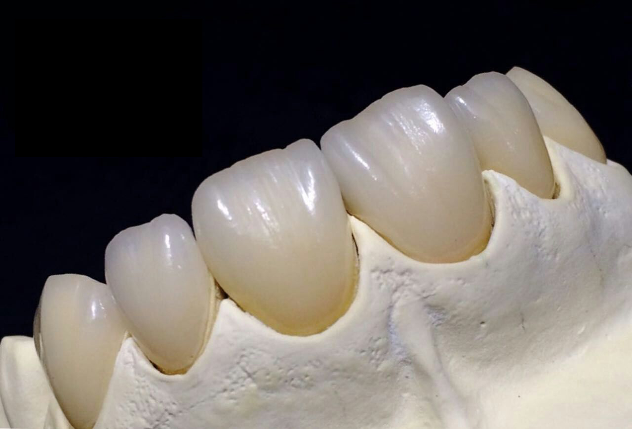 Fullständig Zirconia Crown Kina dental lab