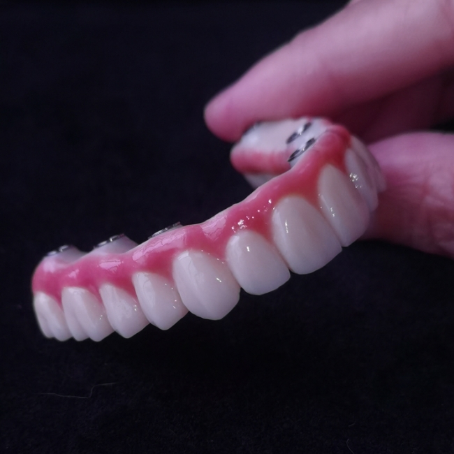 All On X Hybrid Bridge - Full Zirconia Bridge över Tibases