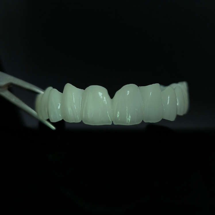 High Translucent Zirconia Bridge Layered Zirconia Kina Dental lab arbete