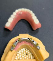 Locator och dental bar