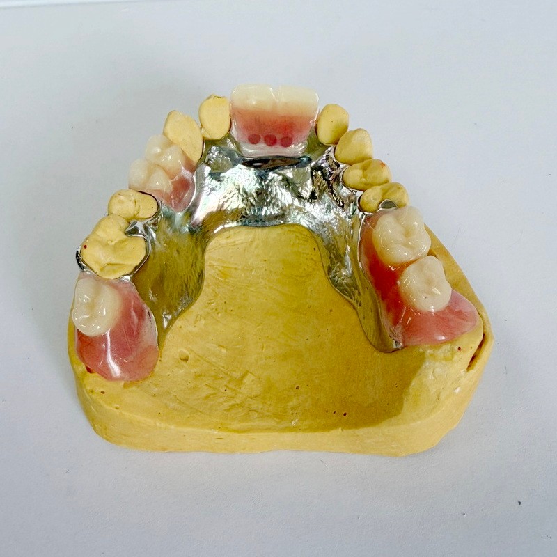 Avtagbar restaurering delvis ram